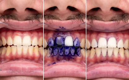 Dentifrice blanchissant violet